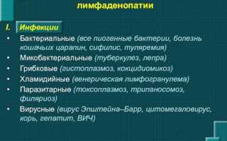 Что такое лимфоаденопатия и как ее лечить