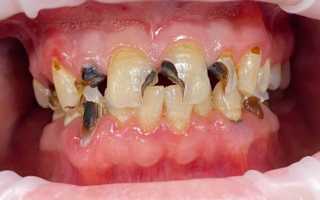 Неприятные последствия после визита к стоматологу