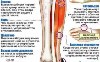 Что вызывает боль в области ноги ниже колена?