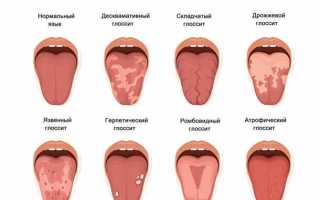 С чем чаще всего связаны неприятные ощущения в полости рта