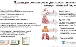 Способы лечения аритмии и рекомендации по выбору метода лечения
