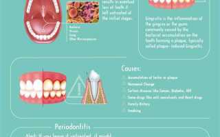 Как лечить десны при беременности