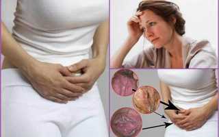 Можно забеременеть при наличии молочницы