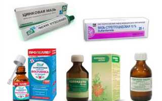 Как лечить пероральный дерматит