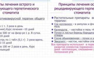 Как вылечить стоматит в домашних условиях