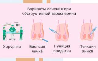 Методы лечения бесплодия у мужчин: эффективные способы и рекомендации