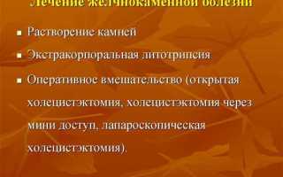 Симптомы желчнокаменной болезни