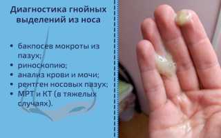 Гнойные выделения из носа