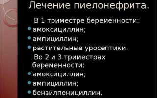 Как лечить цистит у беременных