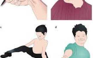 Как лечить мышечную дистонию ног