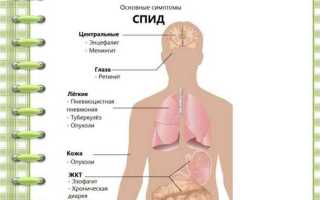 Симптомы спида и вич инфекции
