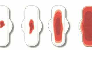 Зачем назначают гексвечи сикон при месячных