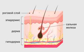 4 причины появления перхоти