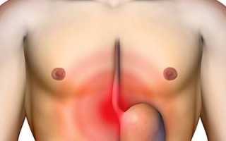 Прежде чем предпринять действия, если в солнечном сплетении образилась шишка, необходимо знать, какие меры могут быть приняты