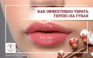 Как избавиться от герпеса за 1 день