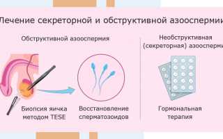 Особенности лечения и методы борьбы с азооспермией