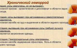 Как вылечить геморрой эффективно и безопасно