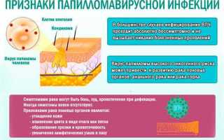 Симптомы ВПЧ у женщин