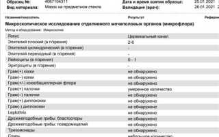 Выделения из уретры: признаки и возможные причины