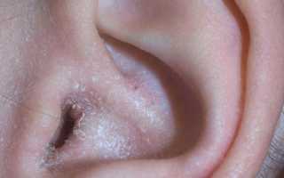 Чешется ушная раковина: причины и методы лечения