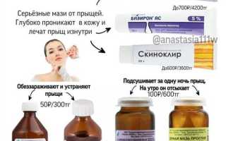 Как избавиться от угрей на лице