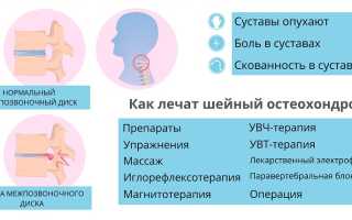 Лечение остеохондроза: эффективные методы