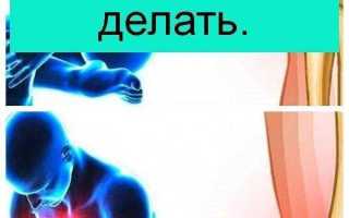 Способы устранения хруста в колене