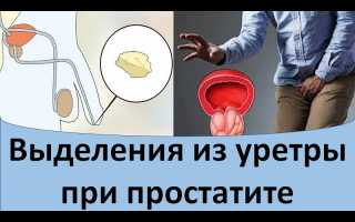 Какие бывают выделения при простатите