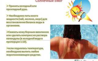 Как лечить солнечные ожоги