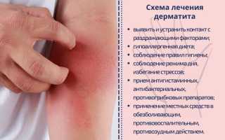 Чем лечить дерматит