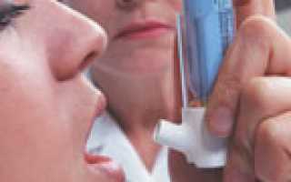 Схема лечения бронхиальной астмы