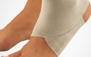 Что делать после перелома ноги