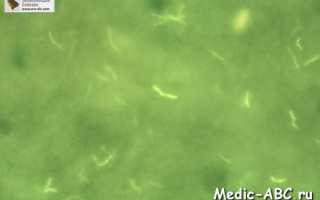 Бородавчатый туберкулез кожи