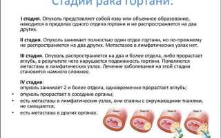 Симптомы рака гортани