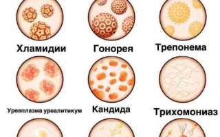 Симптомы венерических заболеваний