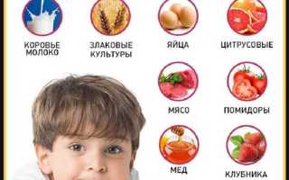 Симптомы аллергии у детей