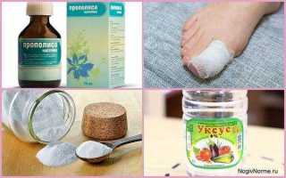 Прополис против грибка: эффективные методы борьбы