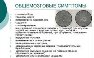 Рак мозга: симптомы и проявления