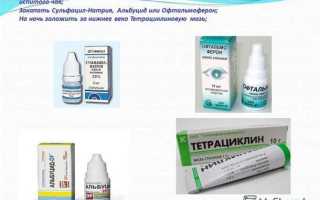 Чем лечить коньюктивит
