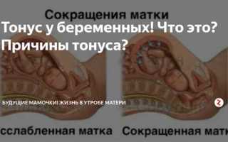 Как лечить гипертонус матки