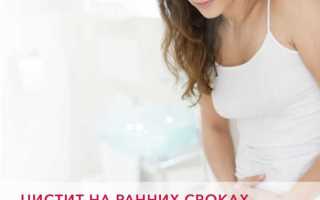 Симптомы цистита при беременности