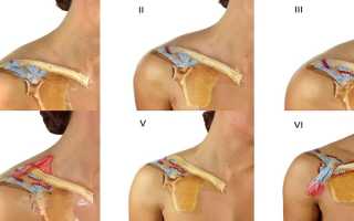 Как лечить растяжение плеча
