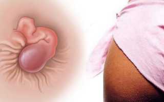 Шишка в заднем проходе, забыть или вылечить?