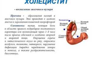 5 вариантов хронического холецистита