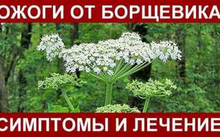 Чем лечить ожоги от борщевика