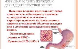 Симптомы язвы желудка и двенадцатиперстной кишки