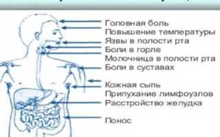Симптомы ВИЧ у мужчин