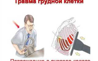 Как лечить ушибы грудной клетки