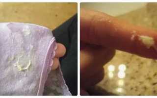 Почему слезает кожа с головки члена