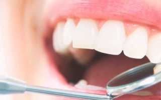 Импланты восстановление утраченных зубов ваш путь к красивой улыбке